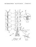 Suture treatment method and kit therefor diagram and image