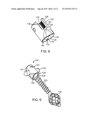 EXPANDABLE SPINAL SUPPORT DEVICE WITH ATTACHABLE MEMBERS AND METHODS OF USE diagram and image