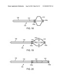 EXPANDABLE SPINAL SUPPORT DEVICE WITH ATTACHABLE MEMBERS AND METHODS OF USE diagram and image