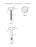 SYSTEM AND METHODS OF MAINTAINING SPACE FOR AUGMENTATION OF THE ALVEOLAR RIDGE diagram and image