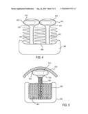 SYSTEM AND METHODS OF MAINTAINING SPACE FOR AUGMENTATION OF THE ALVEOLAR RIDGE diagram and image