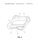 SELF-EXPANDING BONE STABILIZATION DEVICES diagram and image