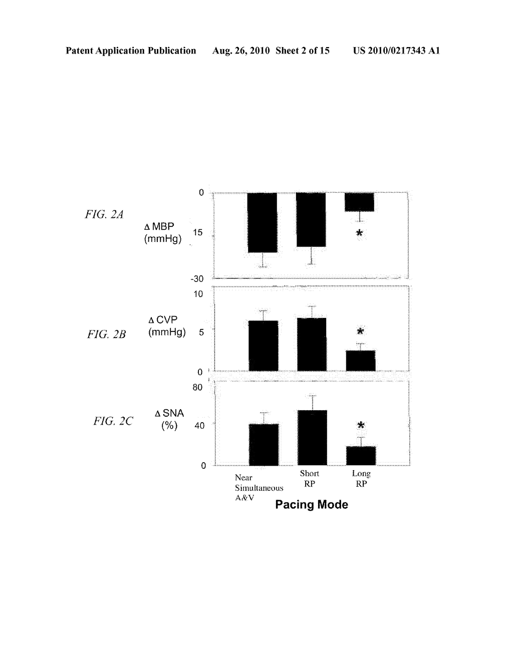 METHODS AND SYSTEMS FOR TREATING VENTRICULAR ARRHYTHMIAS - diagram, schematic, and image 03