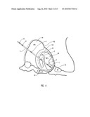 Systems for Monitoring a Patient s Neurological Disease State diagram and image