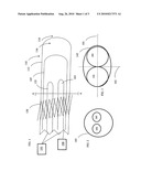 Device, System, and Method for Aiding Stent Valve Deployment diagram and image