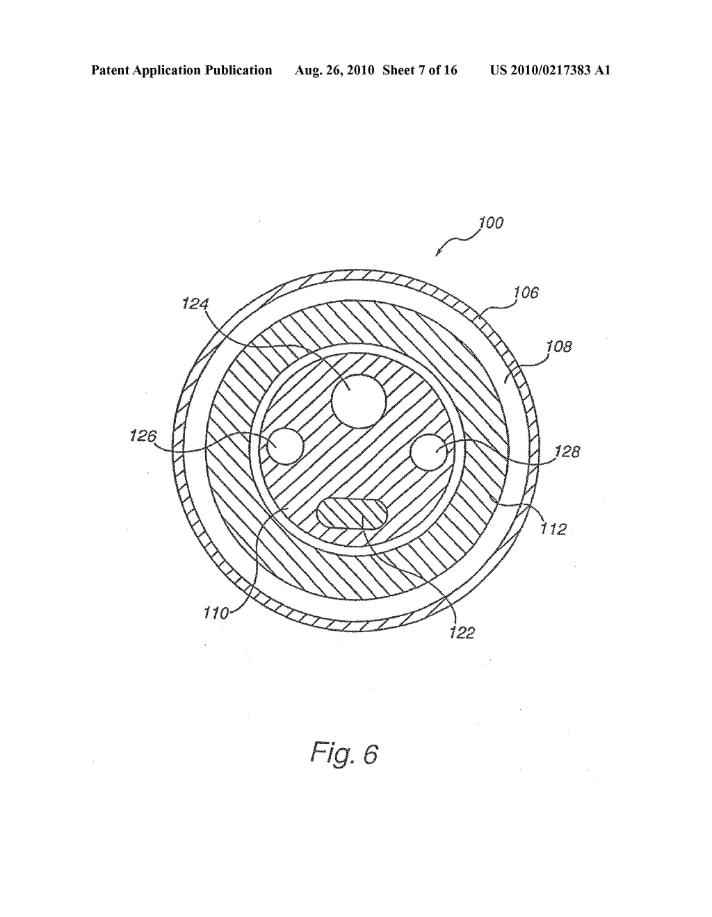 Apparatus for Engrafting a Blood Vessel - diagram, schematic, and image 08