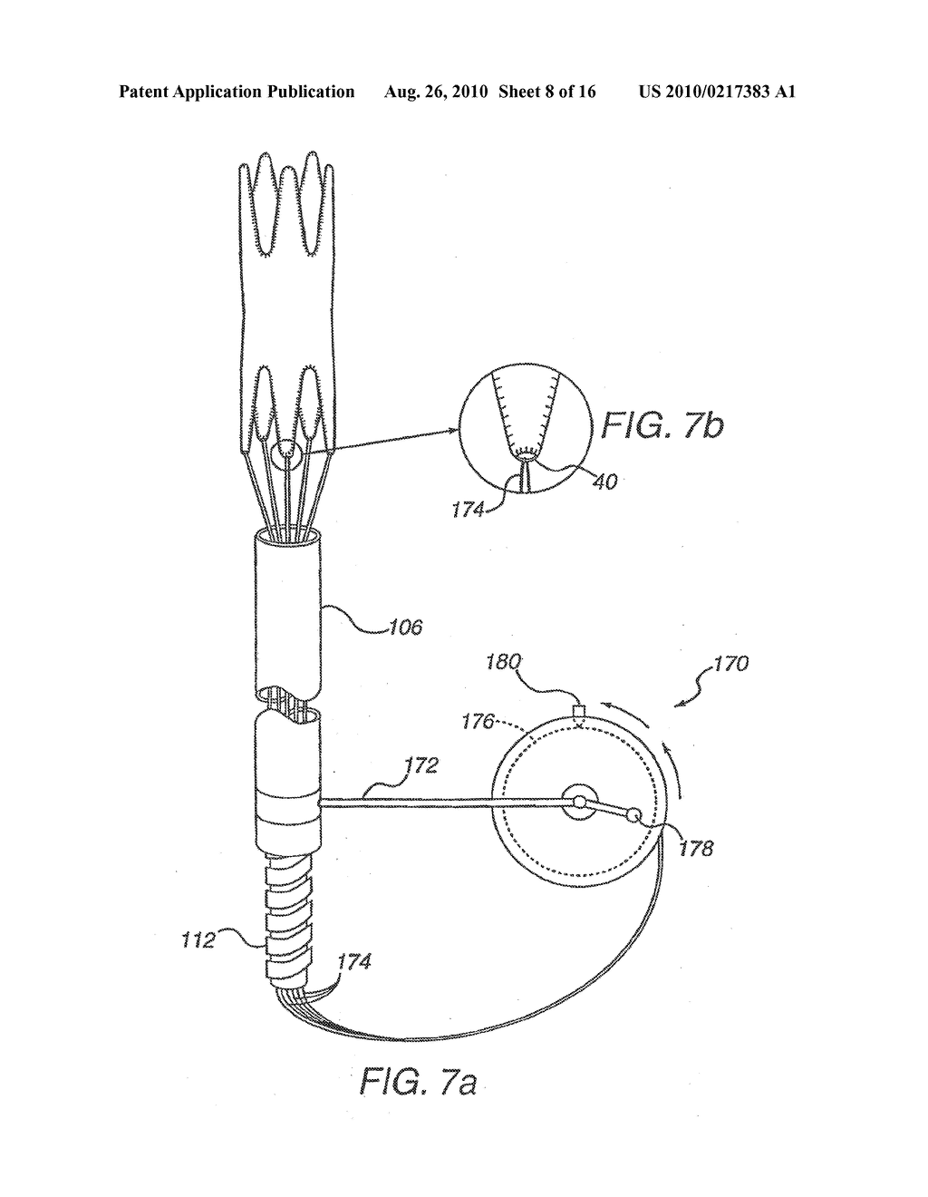 Apparatus for Engrafting a Blood Vessel - diagram, schematic, and image 09