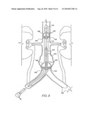 Apparatus for Engrafting a Blood Vessel diagram and image