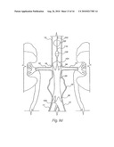 Apparatus for Engrafting a Blood Vessel diagram and image