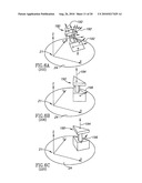 RAPID PRODUCTION APPARATUS diagram and image