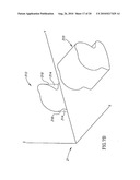 RAPID PRODUCTION APPARATUS diagram and image