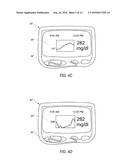 SYSTEM AND METHODS FOR PROCESSING ANALYTE SENSOR DATA diagram and image