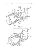 ACTUATOR FOR AN INHALER diagram and image