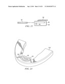 Apparatus and Method for Coupling an Oral Appliance to a Gas Delivery Device diagram and image