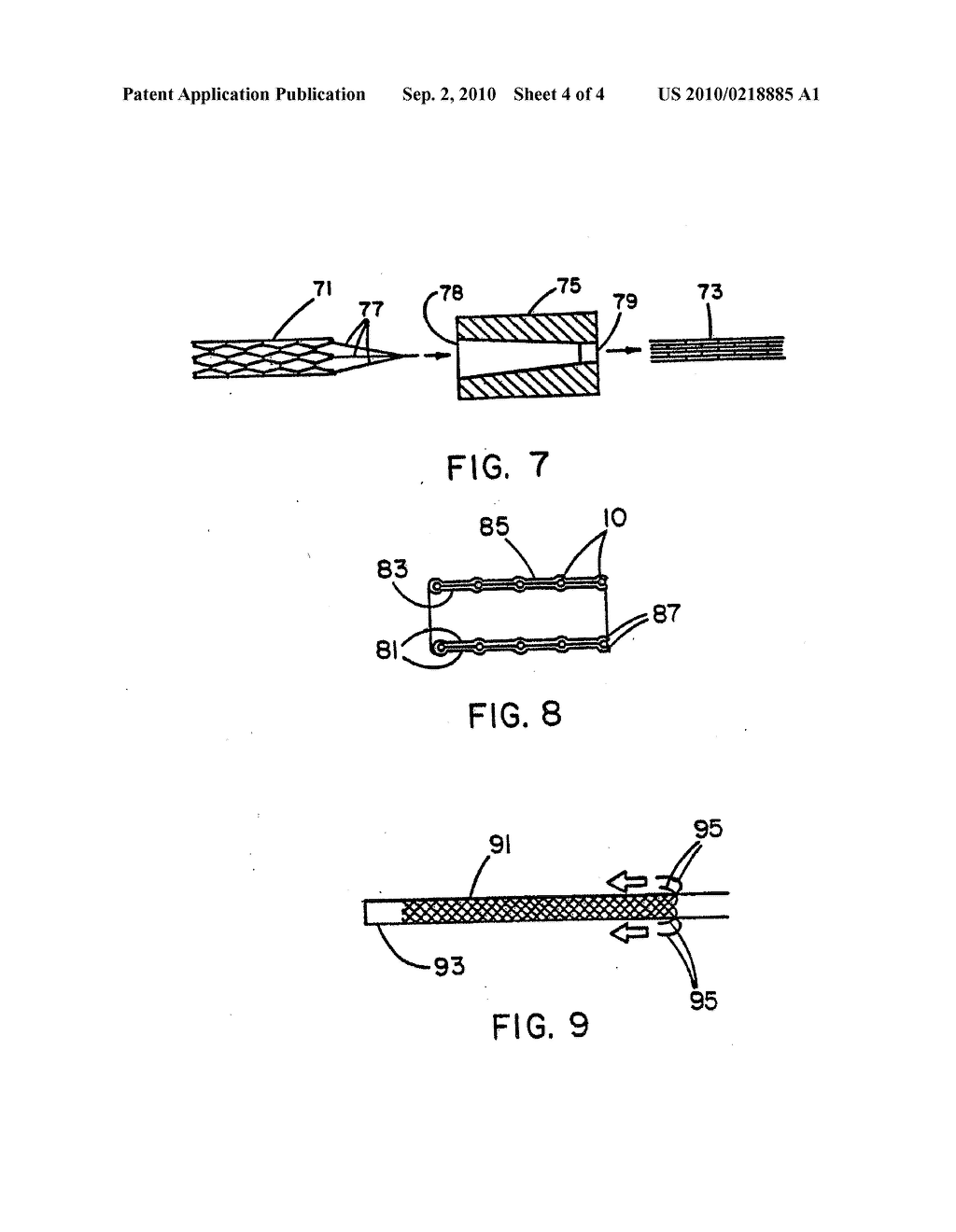 Intraluminal Stent Graft - diagram, schematic, and image 05