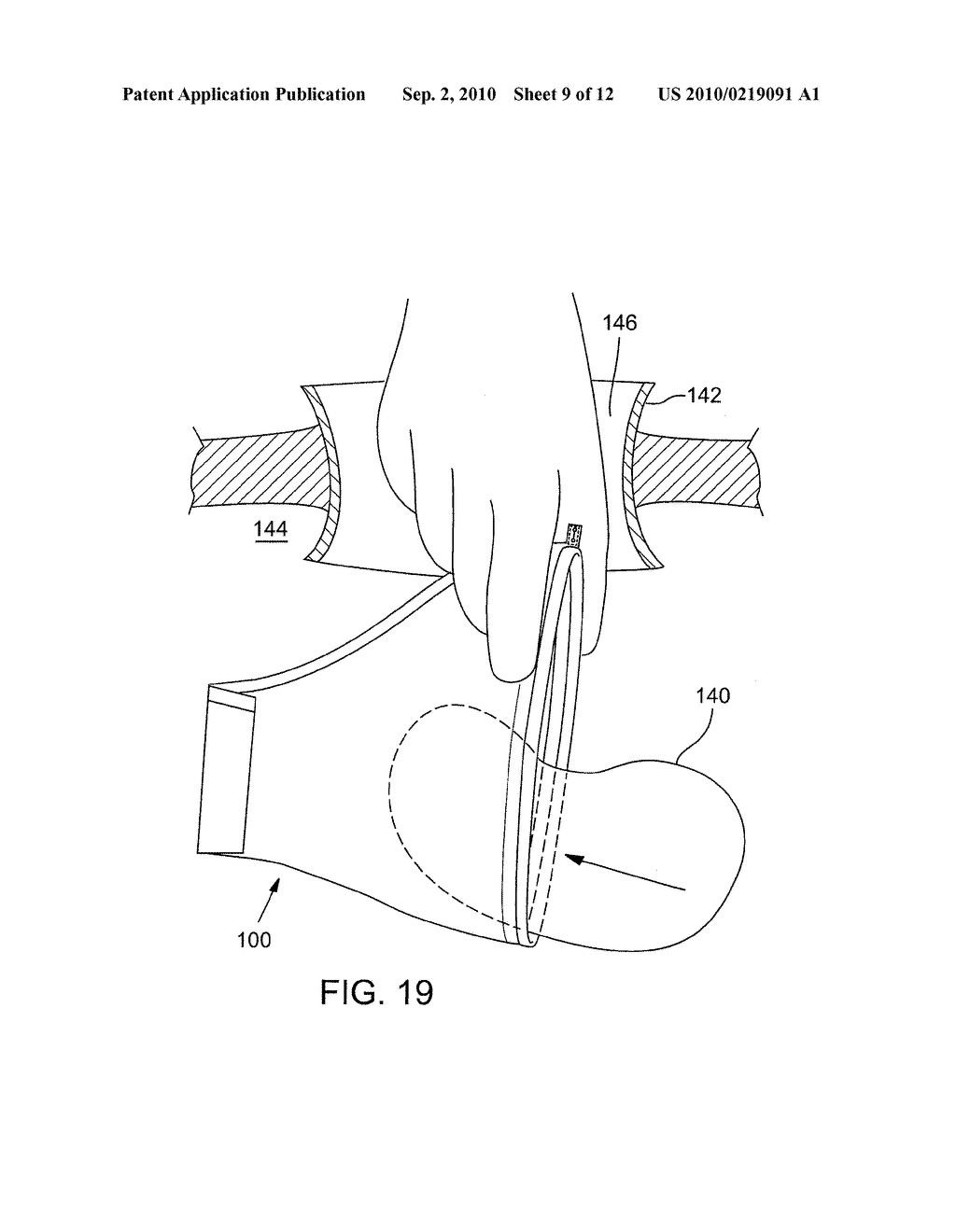 TISSUE RETRIEVAL BAG - diagram, schematic, and image 10