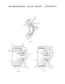 Two-Part Package for Medical Implant diagram and image