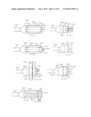 Two-Part Package for Medical Implant diagram and image