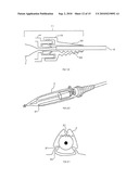 Two-Part Package for Medical Implant diagram and image