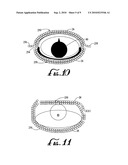 NOVEL POSITRON EMISSION DETECTORS AND CONFIGURATIONS diagram and image