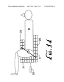 NOVEL POSITRON EMISSION DETECTORS AND CONFIGURATIONS diagram and image