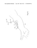 Leak detector for detecting leak of liquid injected into blood vessel using pulse signal diagram and image