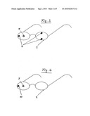 VISUAL AID WITH THREE-DIMENSIONAL IMAGE ACQUISITION diagram and image