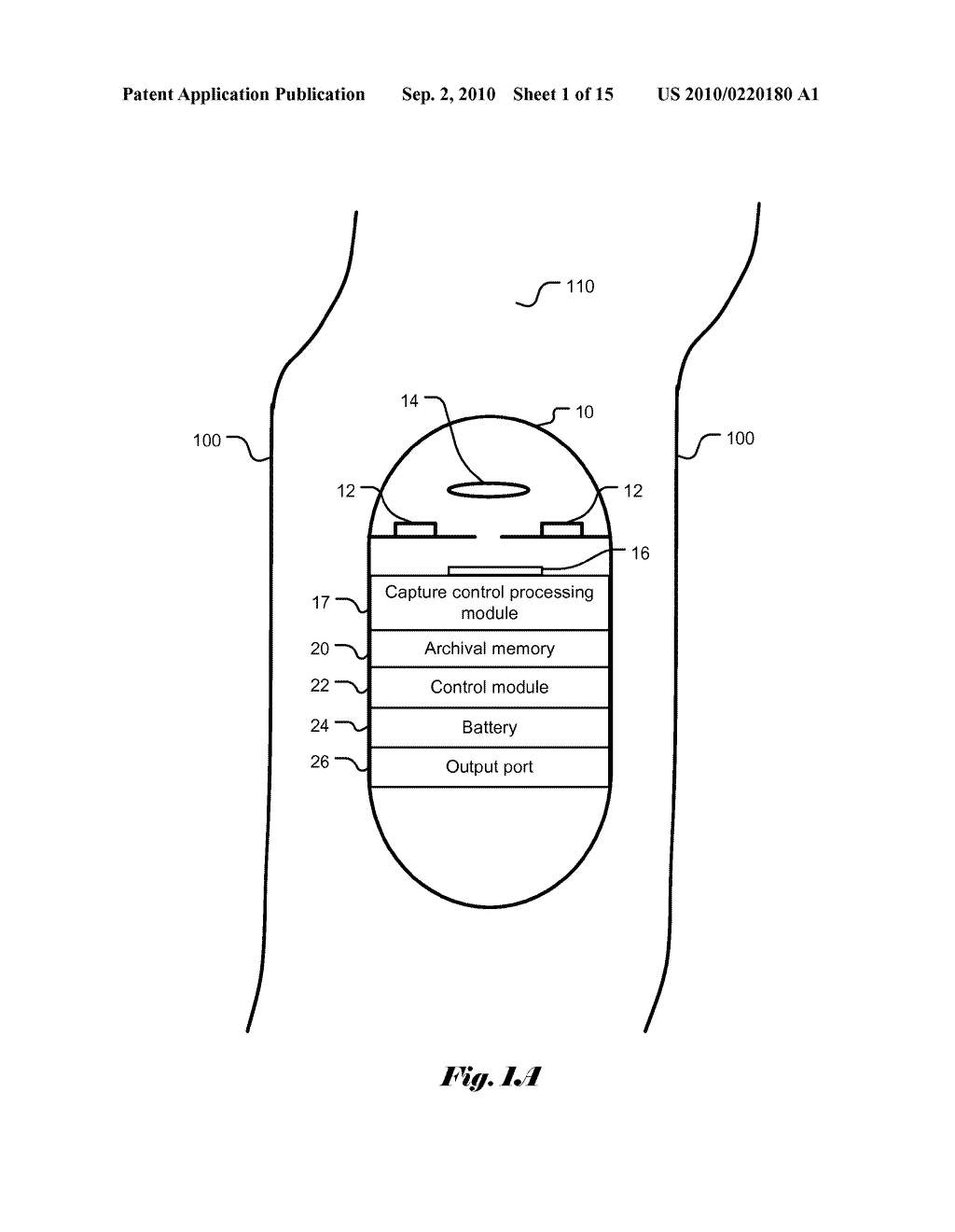 Capture Control for in vivo Camera - diagram, schematic, and image 02