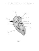 EAR-ATTACHMENT DEVICE AND METHOD diagram and image