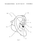 EAR-ATTACHMENT DEVICE AND METHOD diagram and image