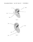 EAR-ATTACHMENT DEVICE AND METHOD diagram and image