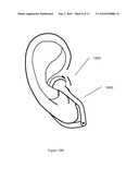 EAR-ATTACHMENT DEVICE AND METHOD diagram and image