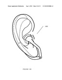 EAR-ATTACHMENT DEVICE AND METHOD diagram and image