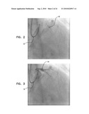 AUTOMATIC GENERATION OF A VASCULAR SKELETON diagram and image