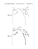 AUTOMATIC GENERATION OF A VASCULAR SKELETON diagram and image