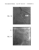 AUTOMATIC GENERATION OF A VASCULAR SKELETON diagram and image