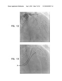 AUTOMATIC GENERATION OF A VASCULAR SKELETON diagram and image