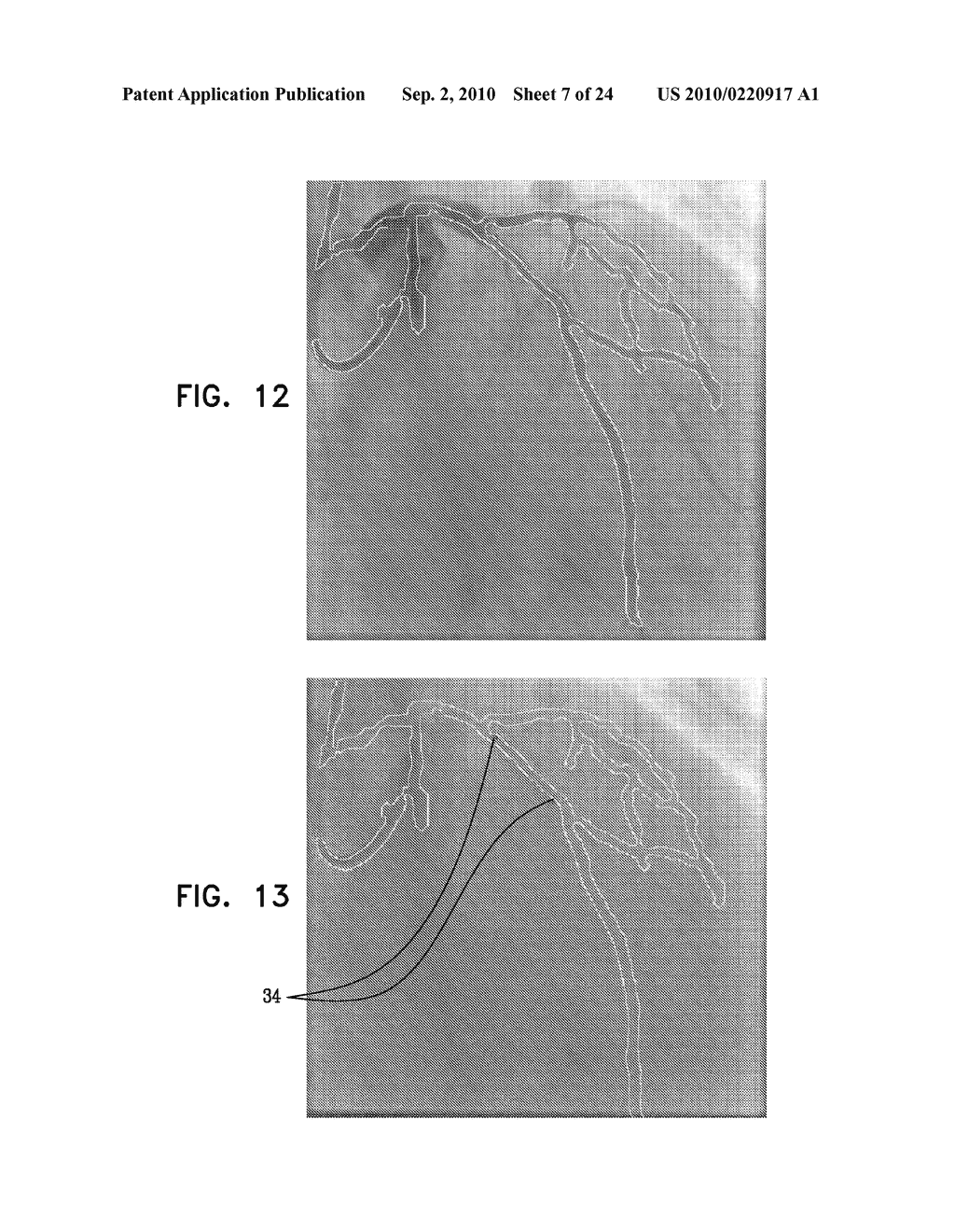 AUTOMATIC GENERATION OF A VASCULAR SKELETON - diagram, schematic, and image 08