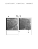 AUTOMATIC GENERATION OF A VASCULAR SKELETON diagram and image