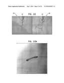 AUTOMATIC GENERATION OF A VASCULAR SKELETON diagram and image