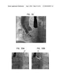 AUTOMATIC GENERATION OF A VASCULAR SKELETON diagram and image