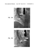 AUTOMATIC GENERATION OF A VASCULAR SKELETON diagram and image