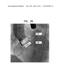 AUTOMATIC GENERATION OF A VASCULAR SKELETON diagram and image