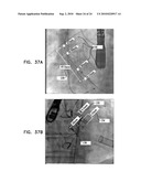 AUTOMATIC GENERATION OF A VASCULAR SKELETON diagram and image