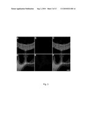 IN VIVO IMAGING OF MYELINATION diagram and image