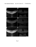 IN VIVO IMAGING OF MYELINATION diagram and image