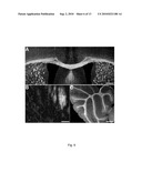 IN VIVO IMAGING OF MYELINATION diagram and image