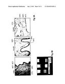 T CELL IMMUNOMODULATION BY PLACENTA CELL PREPARATIONS diagram and image