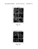 DYNAMIN MEDIATED DISEASES AND ASSOCIATED METHODS AND PRODUCTS diagram and image