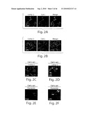 DYNAMIN MEDIATED DISEASES AND ASSOCIATED METHODS AND PRODUCTS diagram and image